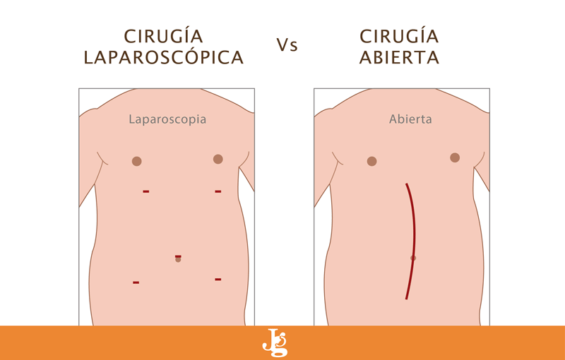 grafica comparativa